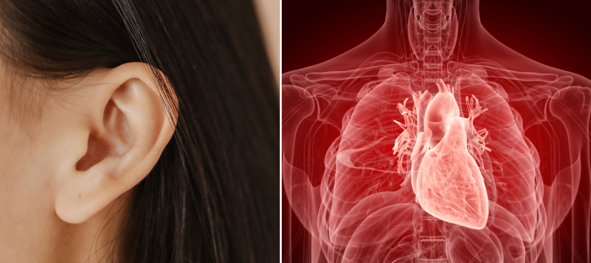 Problemi cardiaci.