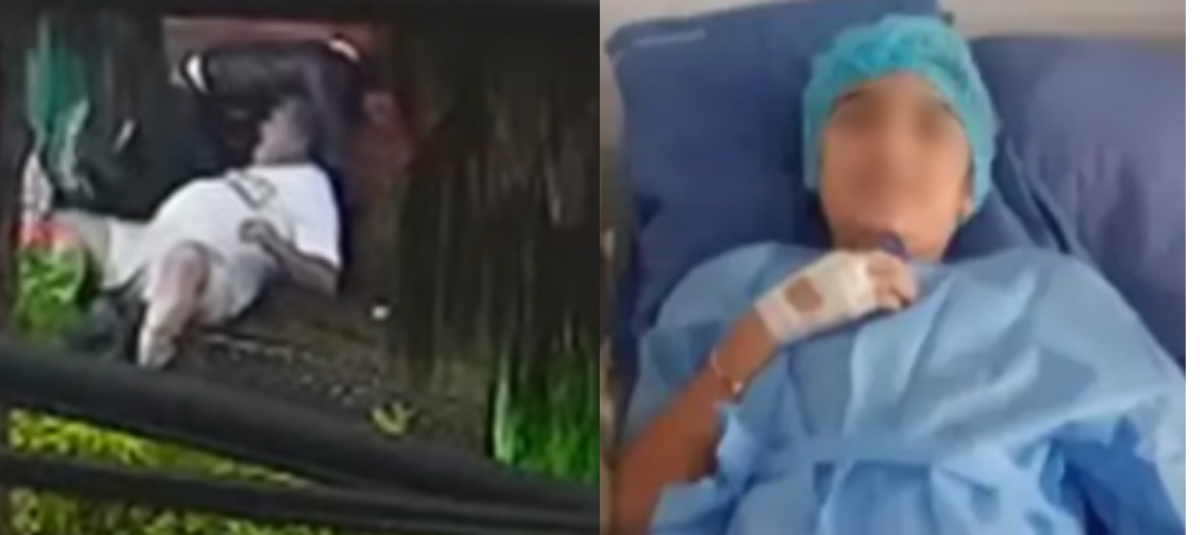 Niña Fue atacada por un perro en bogotá.