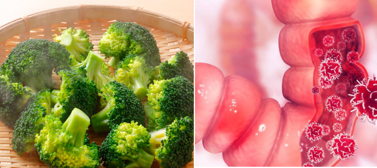 Este alimento verde que seguramente tiene en casa puede reducir un 20 % el riesgo de cáncer de intestino, según nuevo estudio